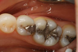 cerac dental before